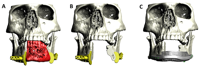 An external file that holds a picture, illustration, etc., usually as some form of binary object. The name of referred object is rmmj-9-3-e0020-g009.gif